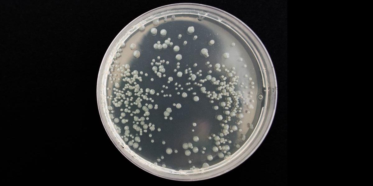 bronchitis Poultry Chicken Bronchitis