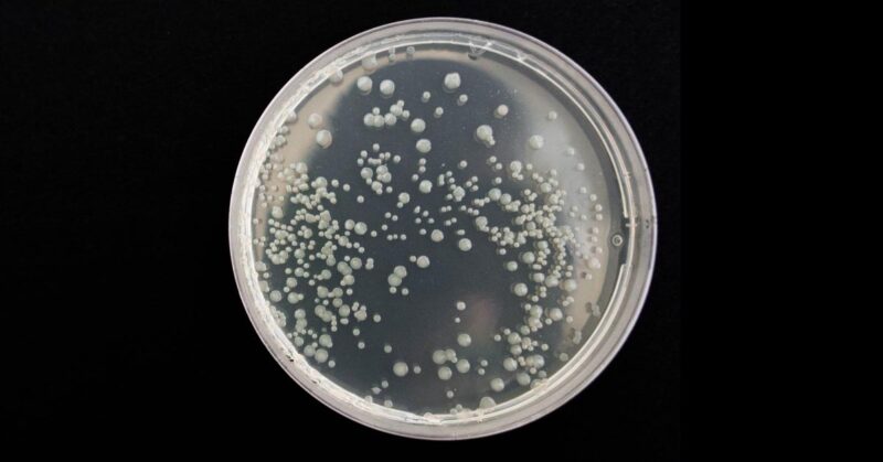 bronchitis Poultry Chicken Bronchitis